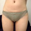Thumbnail of related posts 135