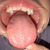 Thumbnail of related posts 081