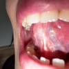 Thumbnail of related posts 060