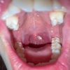 Thumbnail of related posts 040
